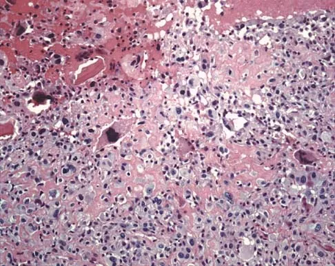 Mtd 2026 MCQs: Board Review Questions & Answers (Part 1) - Figure 167