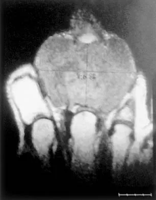 Mtd 2026 MCQs: Board Review Questions & Answers (Part 1) - Figure 173