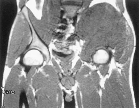 Mtd 2026 MCQs: Board Review Questions & Answers (Part 1) - Figure 19
