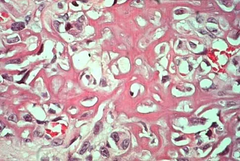 Mtd 2026 MCQs: Board Review Questions & Answers (Part 1) - Figure 197