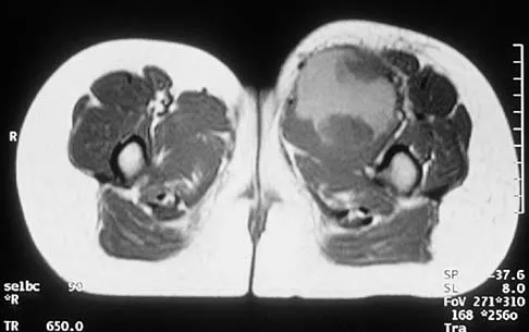 Mtd 2026 MCQs: Board Review Questions & Answers (Part 1) - Figure 201