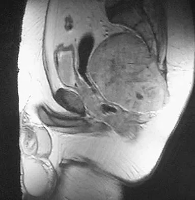 Mtd 2026 MCQs: Board Review Questions & Answers (Part 1) - Figure 211