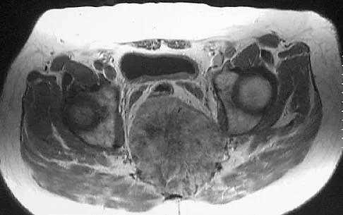 Mtd 2026 MCQs: Board Review Questions & Answers (Part 1) - Figure 213