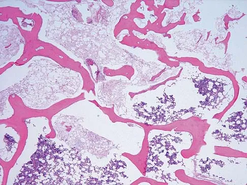 Mtd 2026 MCQs: Board Review Questions & Answers (Part 1) - Figure 217