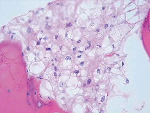 Mtd 2026 MCQs: Board Review Questions & Answers (Part 1) - Figure 219