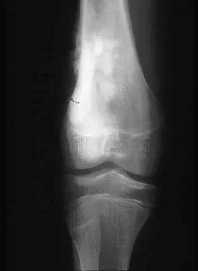 Mtd 2026 MCQs: Board Review Questions & Answers (Part 1) - Figure 221