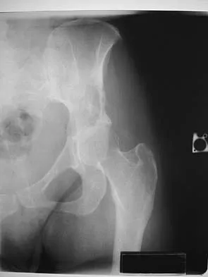 Mtd 2026 MCQs: Board Review Questions & Answers (Part 1) - Figure 223