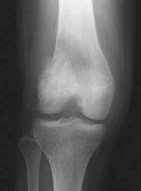 Mtd 2026 MCQs: Board Review Questions & Answers (Part 1) - Figure 241