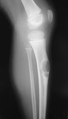 Mtd 2026 MCQs: Board Review Questions & Answers (Part 1) - Figure 249