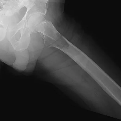 Mtd 2026 MCQs: Board Review Questions & Answers (Part 1) - Figure 257