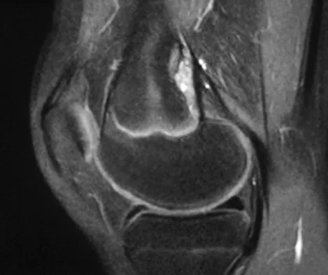Mtd 2026 MCQs: Board Review Questions & Answers (Part 1) - Figure 285