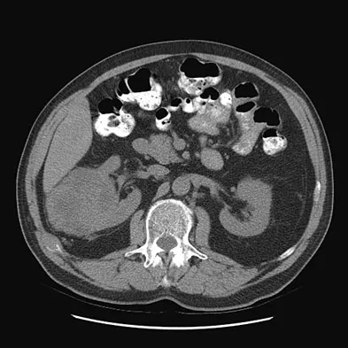 Mtd 2026 MCQs: Board Review Questions & Answers (Part 1) - Figure 293