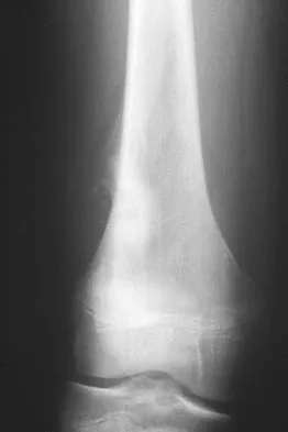 Mtd 2026 MCQs: Board Review Questions & Answers (Part 1) - Figure 297