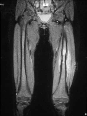 Mtd 2026 MCQs: Board Review Questions & Answers (Part 1) - Figure 3