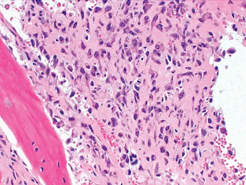 Mtd 2026 MCQs: Board Review Questions & Answers (Part 1) - Figure 305