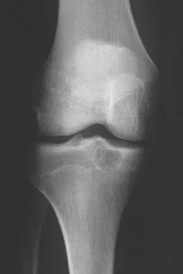 Mtd 2026 MCQs: Board Review Questions & Answers (Part 1) - Figure 309