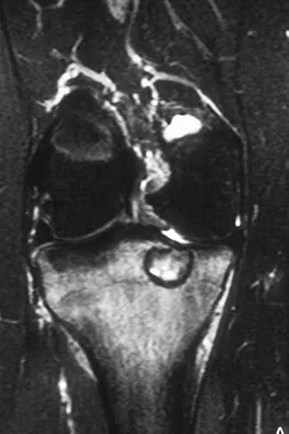 Mtd 2026 MCQs: Board Review Questions & Answers (Part 1) - Figure 311