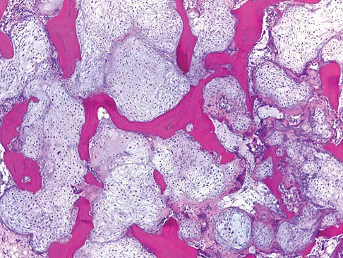 Mtd 2026 MCQs: Board Review Questions & Answers (Part 1) - Figure 319