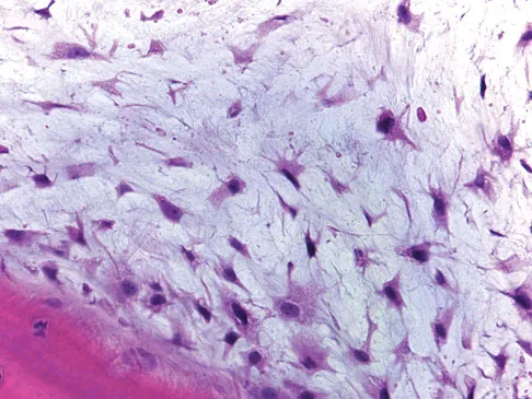 Mtd 2026 MCQs: Board Review Questions & Answers (Part 1) - Figure 321
