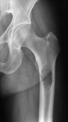 Mtd 2026 MCQs: Board Review Questions & Answers (Part 1) - Figure 35