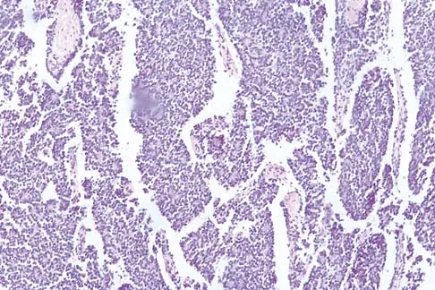 Mtd 2026 MCQs: Board Review Questions & Answers (Part 1) - Figure 5