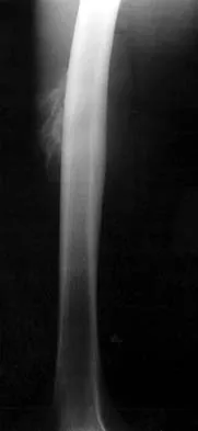 Mtd 2026 MCQs: Board Review Questions & Answers (Part 1) - Figure 57