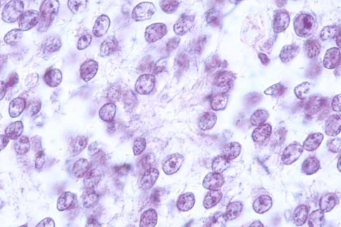 Mtd 2026 MCQs: Board Review Questions & Answers (Part 1) - Figure 7