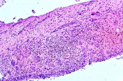 Mtd 2026 MCQs: Board Review Questions & Answers (Part 1) - Figure 77