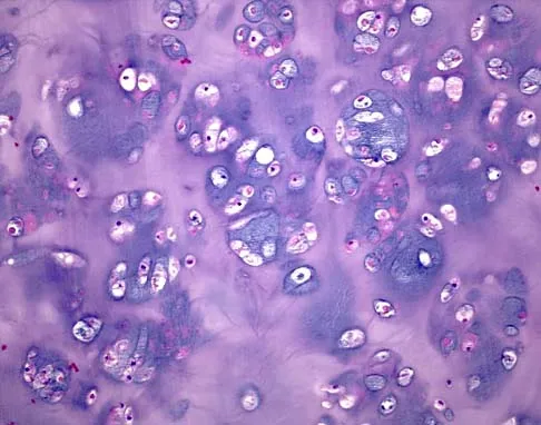 Mtd 2026 MCQs: Board Review Questions & Answers (Part 2) - Figure 113