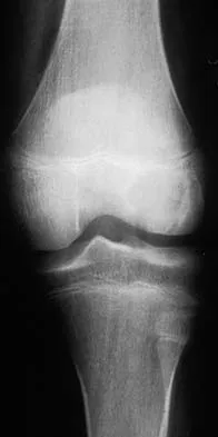 Mtd 2026 MCQs: Board Review Questions & Answers (Part 2) - Figure 117