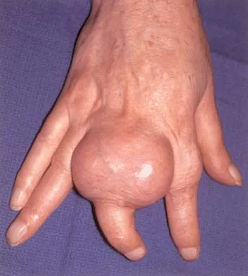 Mtd 2026 MCQs: Board Review Questions & Answers (Part 2) - Figure 127