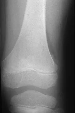 Mtd 2026 MCQs: Board Review Questions & Answers (Part 2) - Figure 137