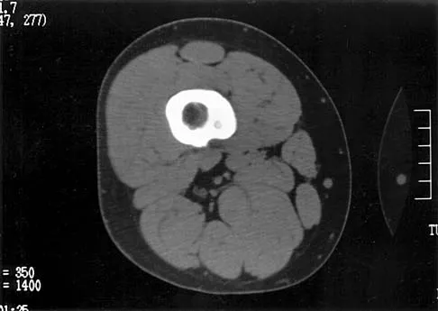 Mtd 2026 MCQs: Board Review Questions & Answers (Part 2) - Figure 143