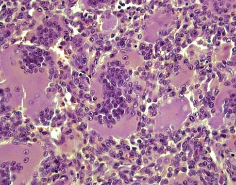 Mtd 2026 MCQs: Board Review Questions & Answers (Part 2) - Figure 15