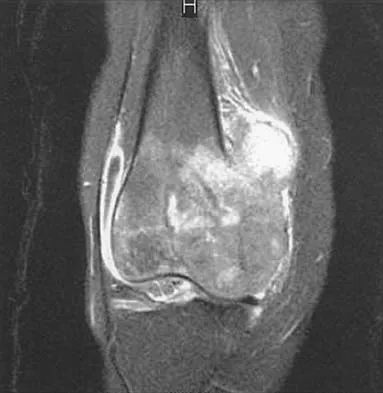 Mtd 2026 MCQs: Board Review Questions & Answers (Part 2) - Figure 153