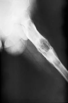 Mtd 2026 MCQs: Board Review Questions & Answers (Part 2) - Figure 159