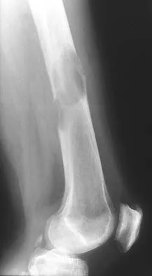 Mtd 2026 MCQs: Board Review Questions & Answers (Part 2) - Figure 169