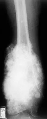 Mtd 2026 MCQs: Board Review Questions & Answers (Part 2) - Figure 173