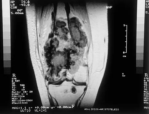 Mtd 2026 MCQs: Board Review Questions & Answers (Part 2) - Figure 175