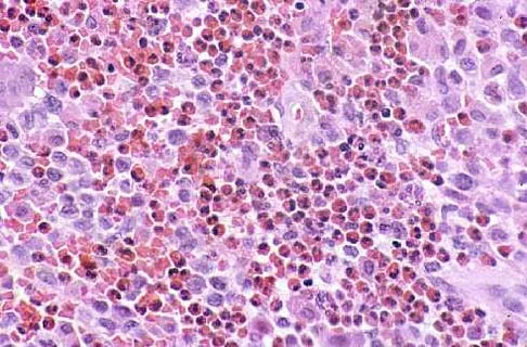 Mtd 2026 MCQs: Board Review Questions & Answers (Part 2) - Figure 189