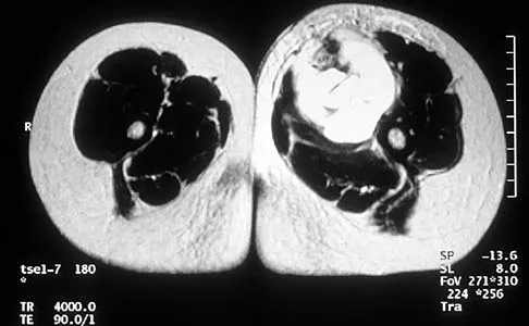 Mtd 2026 MCQs: Board Review Questions & Answers (Part 2) - Figure 205