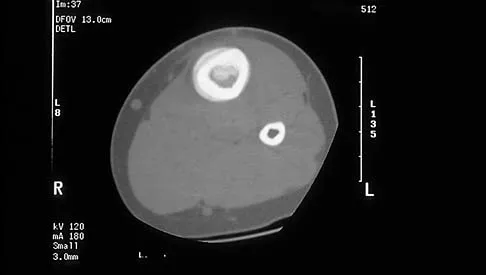 Mtd 2026 MCQs: Board Review Questions & Answers (Part 2) - Figure 21