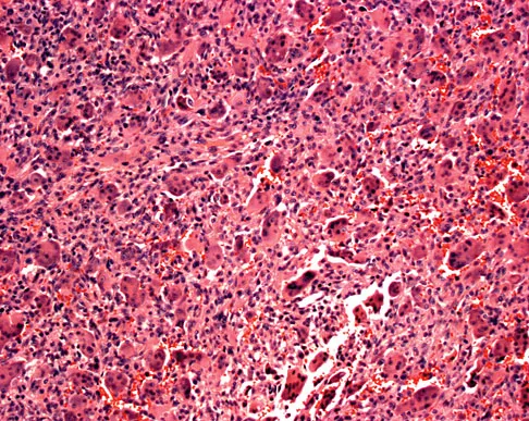 Mtd 2026 MCQs: Board Review Questions & Answers (Part 2) - Figure 217