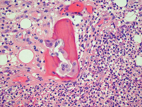 Mtd 2026 MCQs: Board Review Questions & Answers (Part 2) - Figure 219