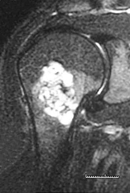 Mtd 2026 MCQs: Board Review Questions & Answers (Part 2) - Figure 227