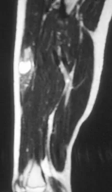 Mtd 2026 MCQs: Board Review Questions & Answers (Part 2) - Figure 233