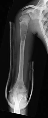 Mtd 2026 MCQs: Board Review Questions & Answers (Part 2) - Figure 235