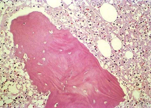 Mtd 2026 MCQs: Board Review Questions & Answers (Part 2) - Figure 25