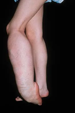 Mtd 2026 MCQs: Board Review Questions & Answers (Part 2) - Figure 41