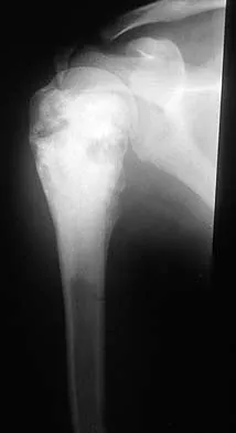 Mtd 2026 MCQs: Board Review Questions & Answers (Part 2) - Figure 55